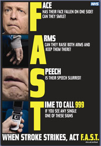 Pic: Stroke campaign poster - click to download the image