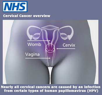 Image: NHS graphic on female re reproductive system - click to go to website