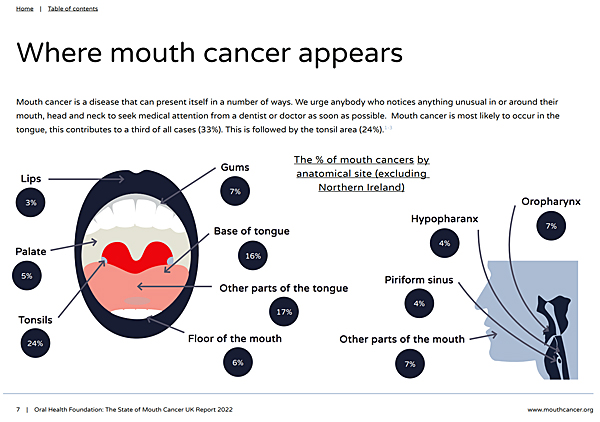 image: Click to download the Mouth Cancer Report